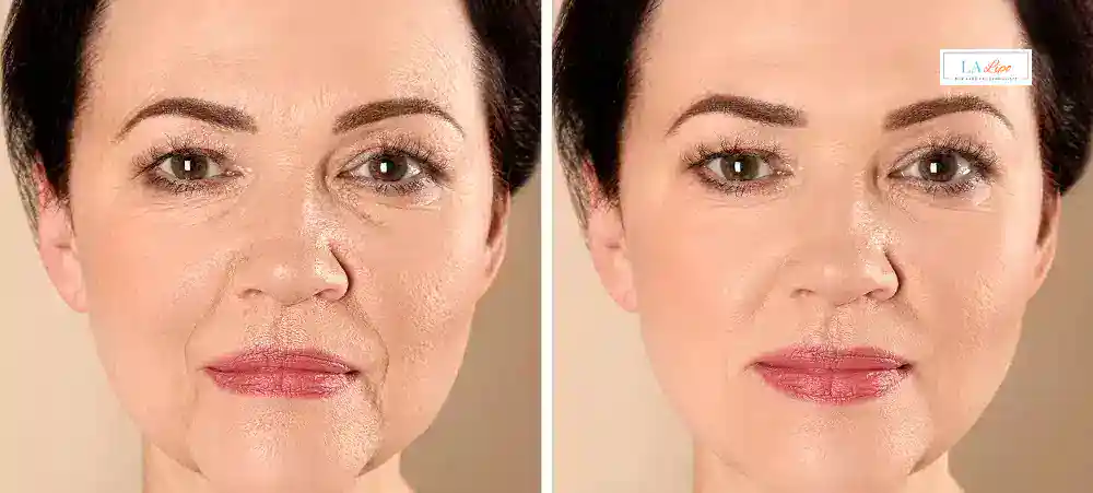 Why Aren’t My Skincare Products Making My Sagging Skin Look Firmer East Grinstead?